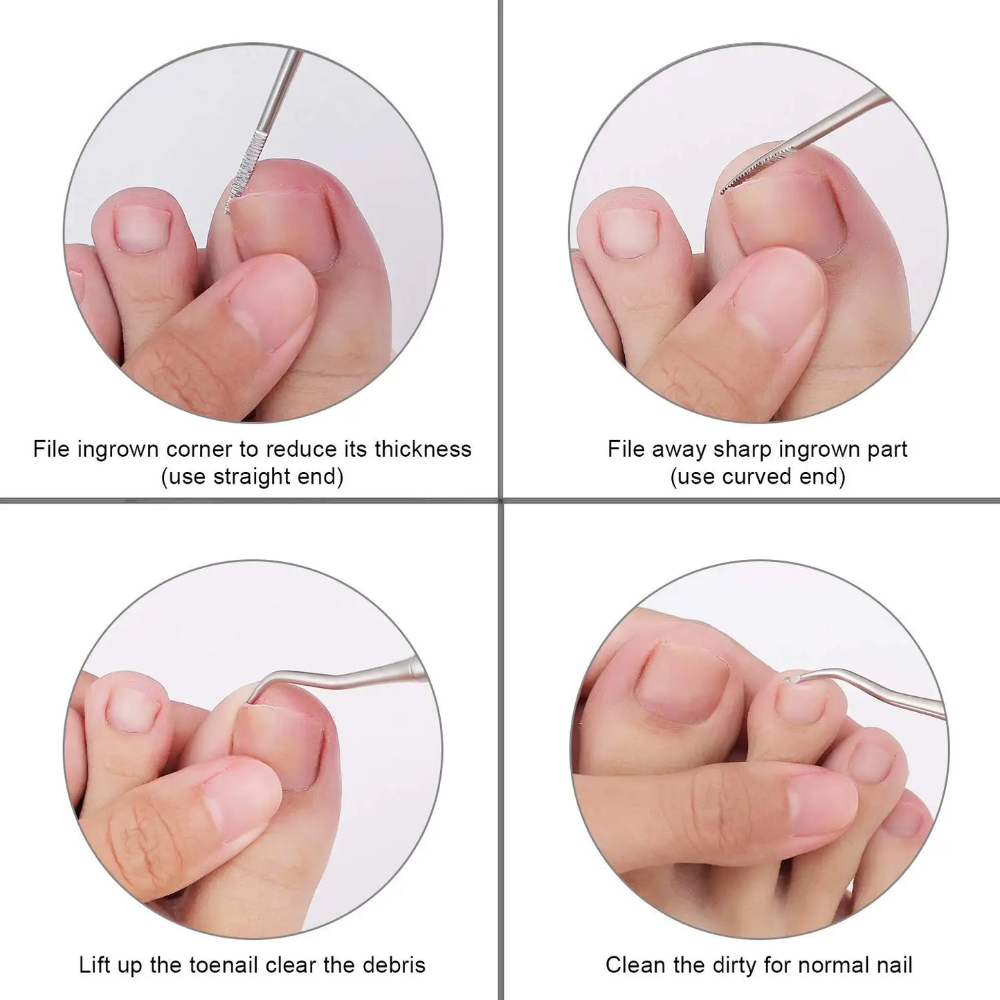 Coupe-Ongles Professionnel Orteils Incarnés | Pince Podologue Acier Inoxydable | Outil Médical Spécialisé