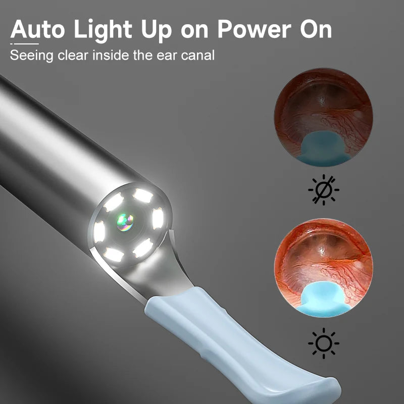 Caméra Auriculaire Visuelle Intelligente - Nettoyeur d'oreille numérique